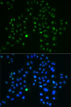 Nucleostemin Antibody in Immunocytochemistry (ICC/IF)