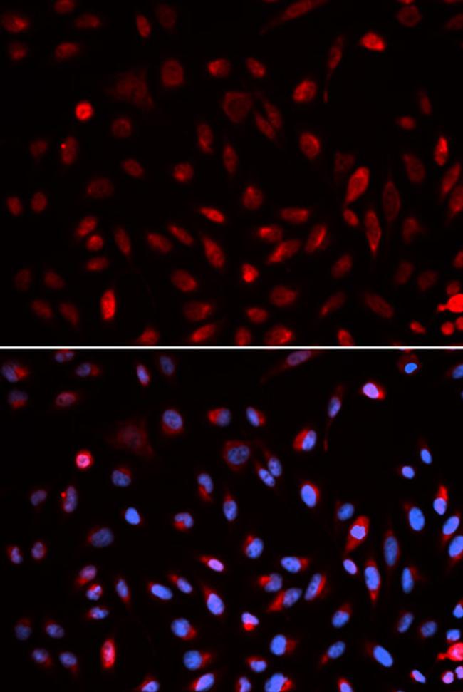 ERCC1 Antibody in Immunocytochemistry (ICC/IF)