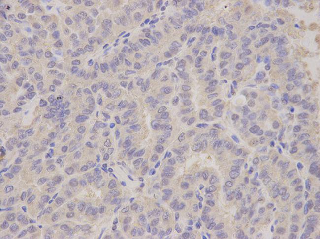 ALDH3A1 Antibody in Immunohistochemistry (Paraffin) (IHC (P))