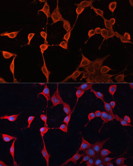 DNAJA2 Antibody in Immunocytochemistry (ICC/IF)