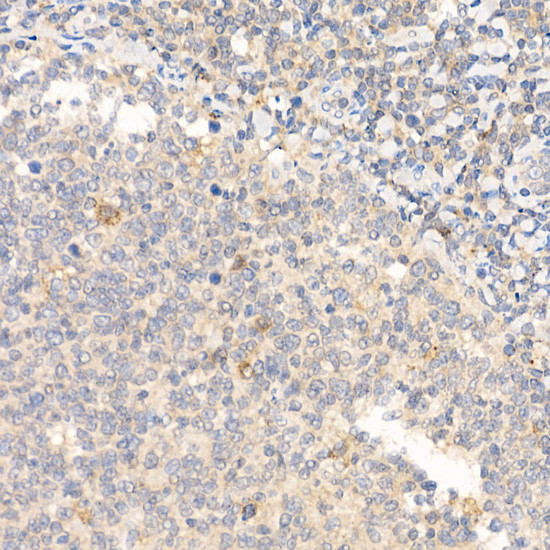 IL-21 Antibody in Immunohistochemistry (Paraffin) (IHC (P))