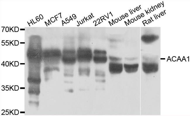 ACAA1 Antibody in Western Blot (WB)