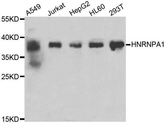 hnRNP A1 Antibody in Western Blot (WB)