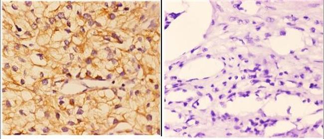 PIK3CG Antibody in Immunohistochemistry (Paraffin) (IHC (P))