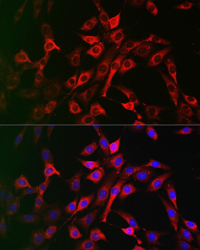 LRP5 Antibody in Immunocytochemistry (ICC/IF)