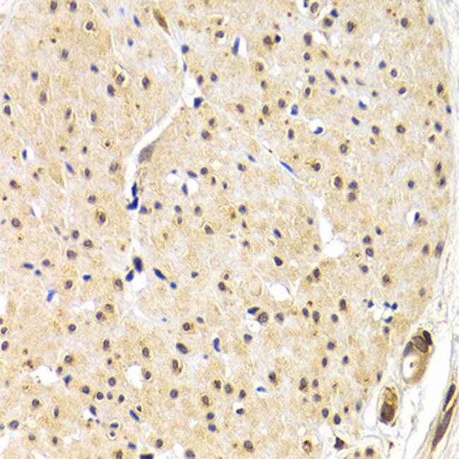 TRF1 Antibody in Immunohistochemistry (Paraffin) (IHC (P))