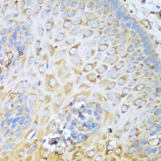 MYH9 Antibody in Immunohistochemistry (Paraffin) (IHC (P))