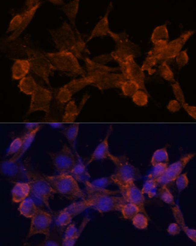 beta Arrestin 1 Antibody in Immunocytochemistry (ICC/IF)