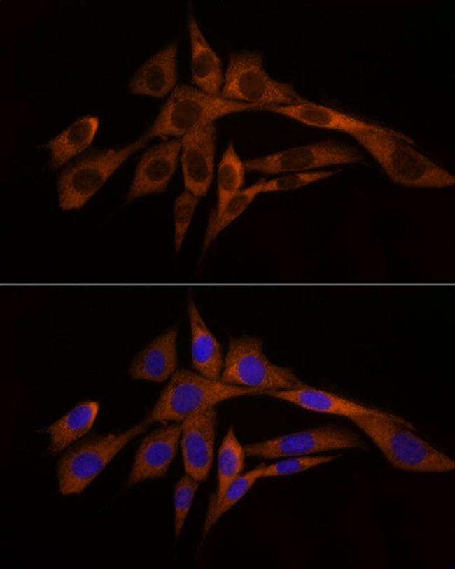 Caspase 8 Antibody in Immunocytochemistry (ICC/IF)