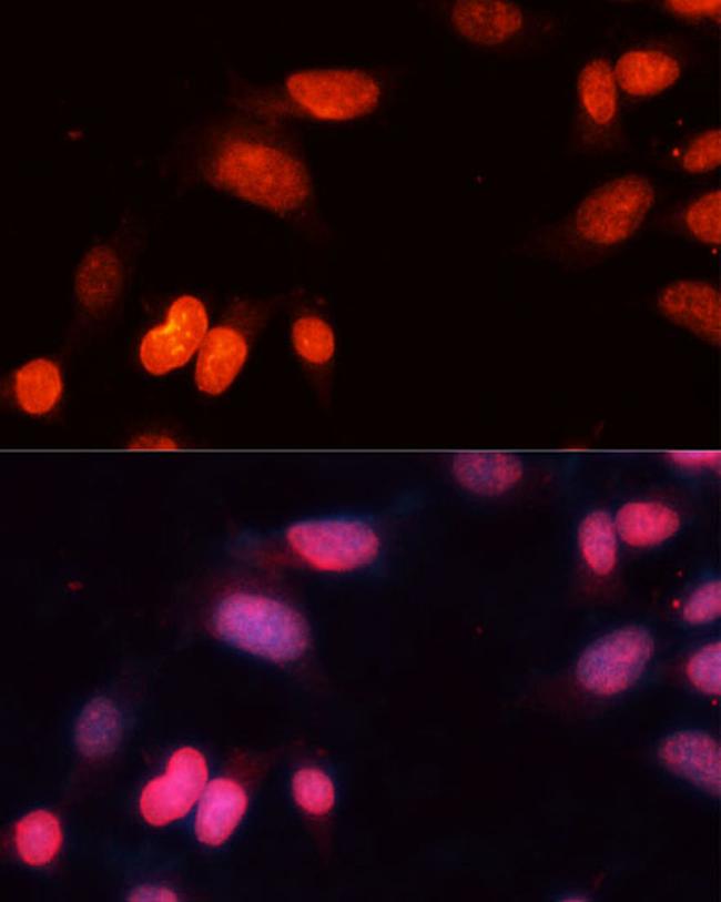 SIRT1 Antibody in Immunocytochemistry (ICC/IF)