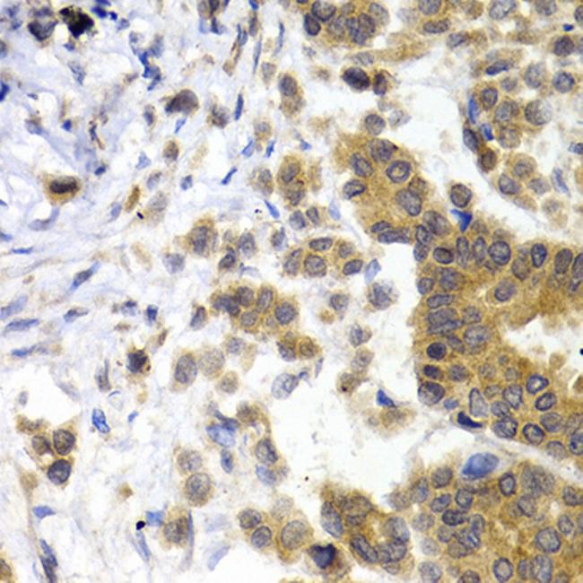 NEFL Antibody in Immunohistochemistry (Paraffin) (IHC (P))