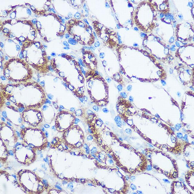 NME1 Antibody in Immunohistochemistry (Paraffin) (IHC (P))