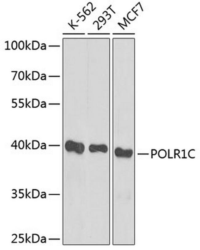 POLR1C Antibody in Western Blot (WB)