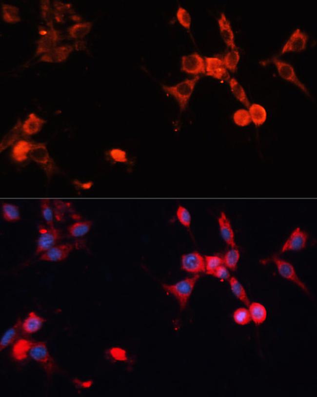 HSP70 Antibody in Immunocytochemistry (ICC/IF)