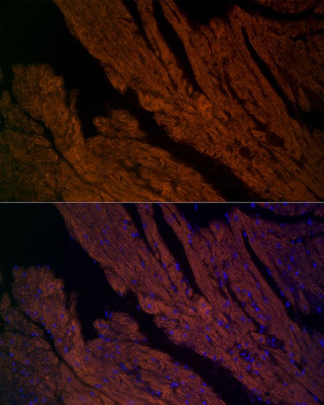 RyR2 Antibody in Immunocytochemistry (ICC/IF)