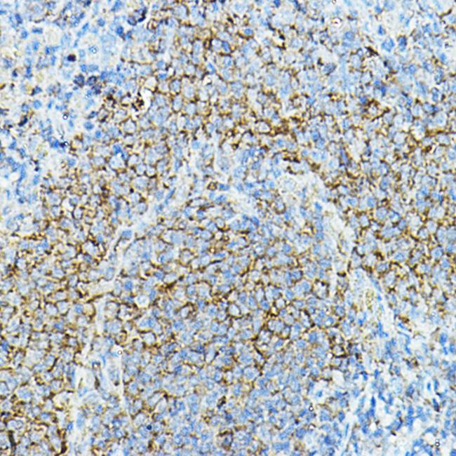 CD79a Antibody in Immunohistochemistry (Paraffin) (IHC (P))