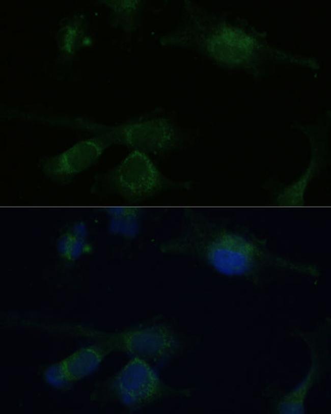 VHL Antibody in Immunocytochemistry (ICC/IF)