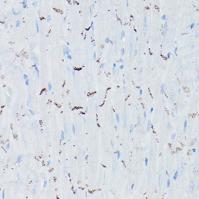 N-cadherin Antibody in Immunohistochemistry (Paraffin) (IHC (P))