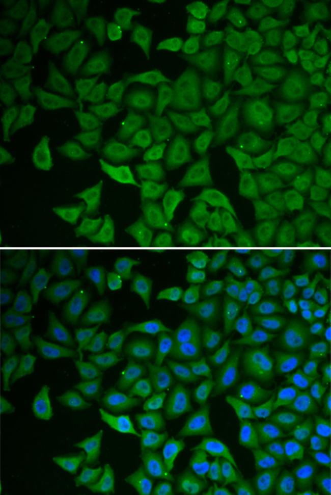 CHK2 Antibody in Immunocytochemistry (ICC/IF)