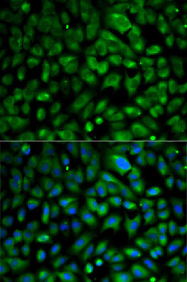 eIF4E Antibody in Immunocytochemistry (ICC/IF)