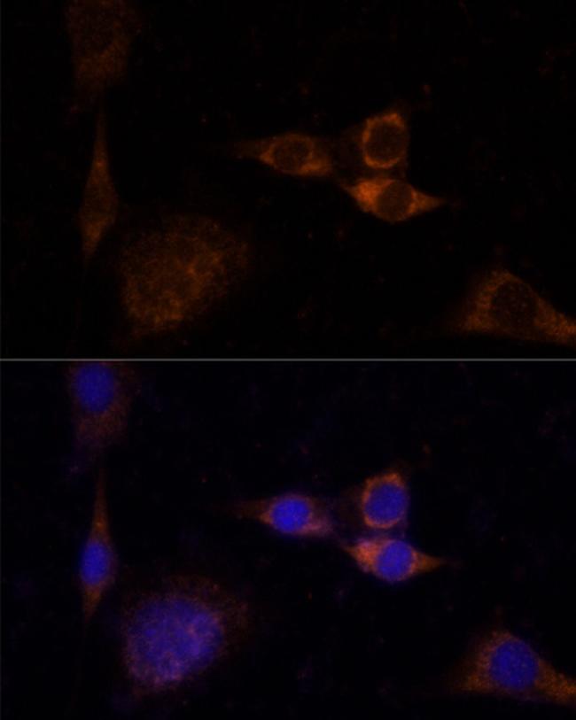 PKC delta Antibody in Immunocytochemistry (ICC/IF)