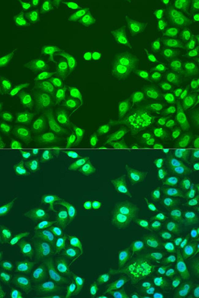 NuMA Antibody in Immunocytochemistry (ICC/IF)