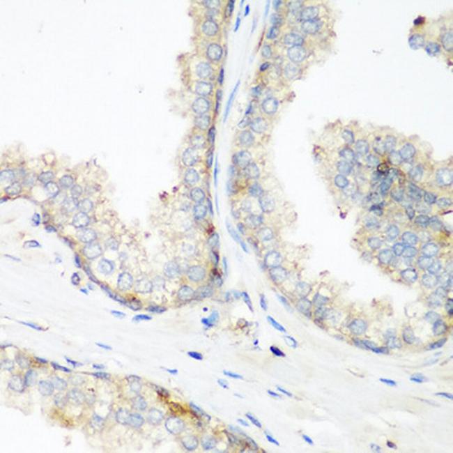 NEDD4 Antibody in Immunohistochemistry (Paraffin) (IHC (P))