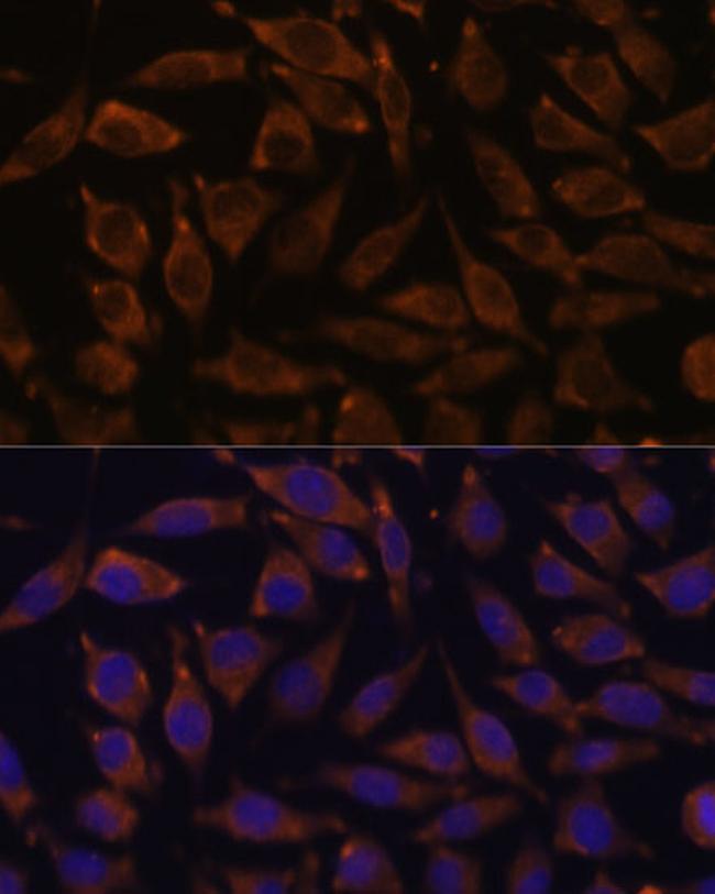 NOTCH2 Antibody in Immunocytochemistry (ICC/IF)