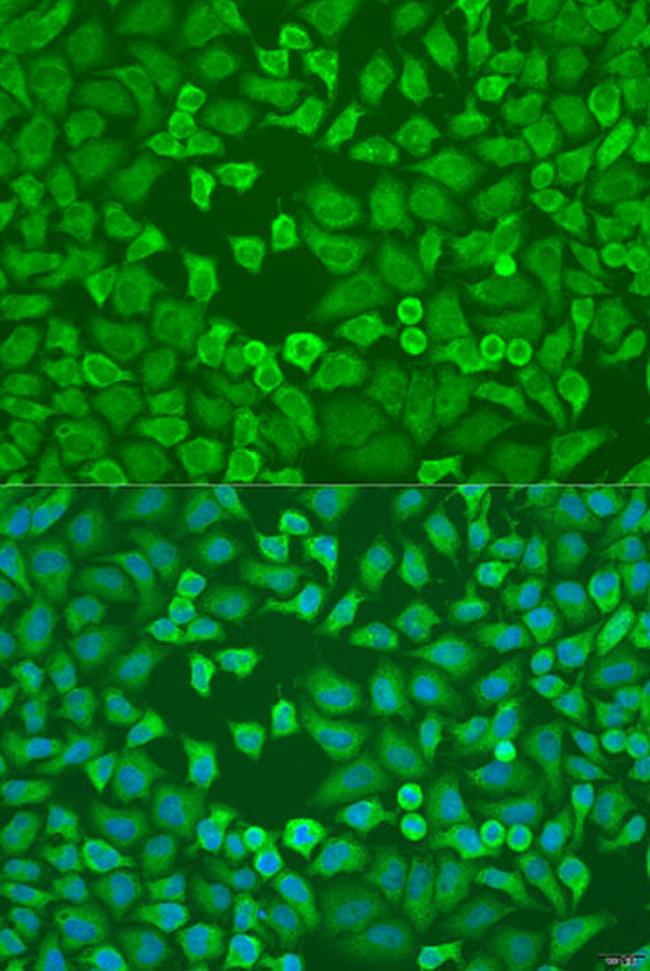 eIF3a Antibody in Immunocytochemistry (ICC/IF)