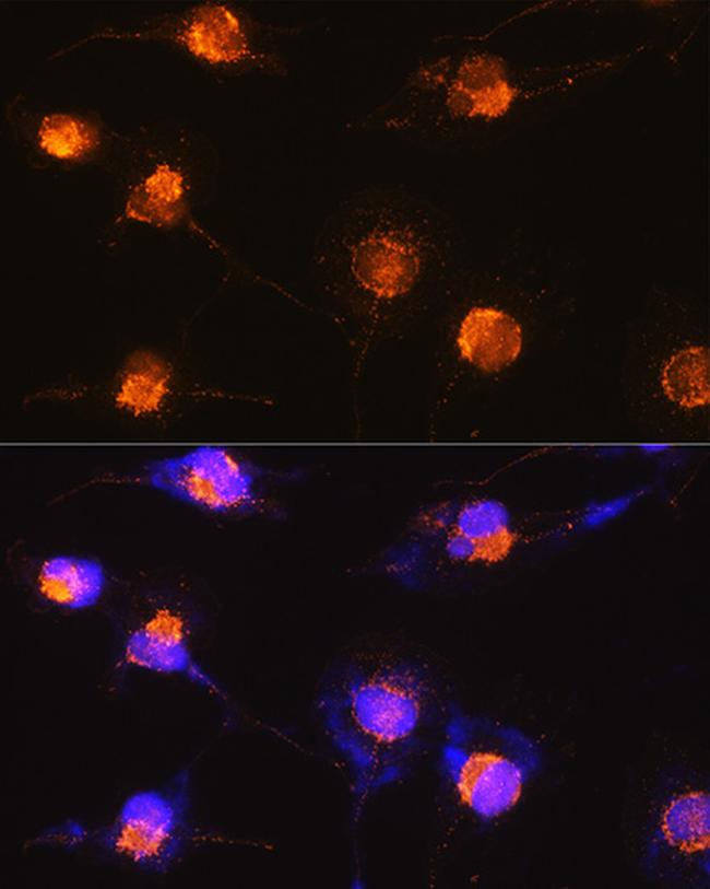 S100B Antibody in Immunocytochemistry (ICC/IF)