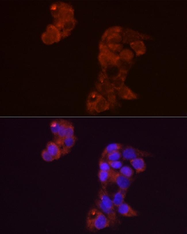 FGF1 Antibody in Immunocytochemistry (ICC/IF)