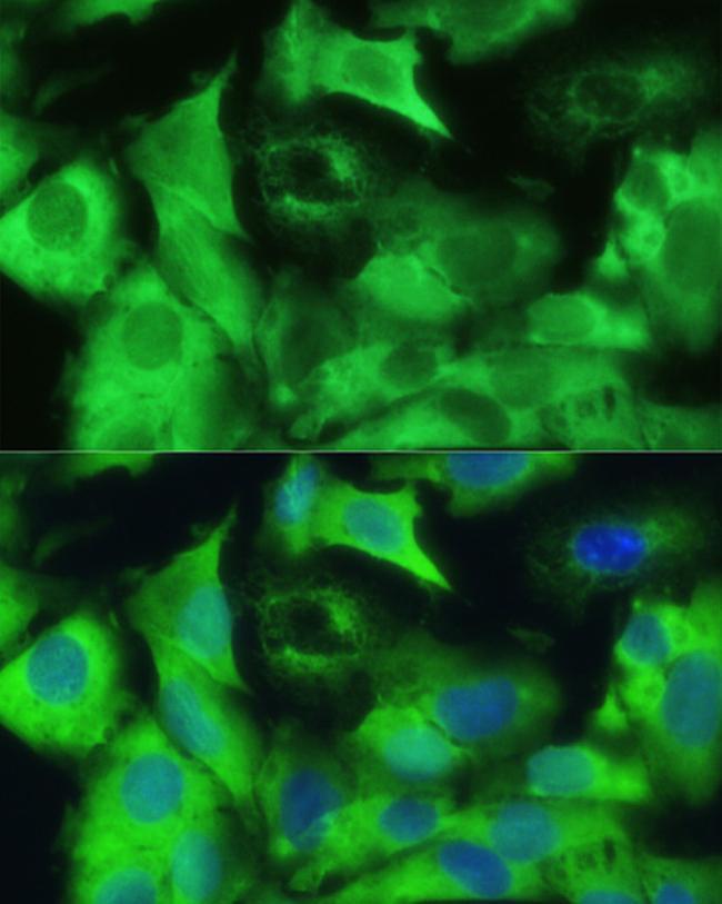 Ezrin Antibody in Immunocytochemistry (ICC/IF)