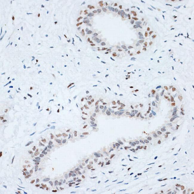 HMGB1 Antibody in Immunohistochemistry (Paraffin) (IHC (P))