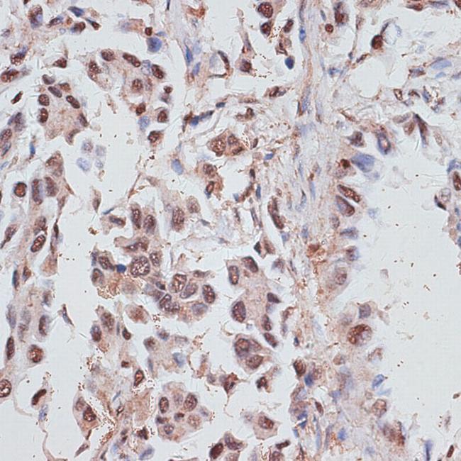 RPA70 Antibody in Immunohistochemistry (Paraffin) (IHC (P))