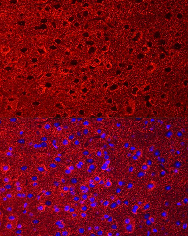 GLT-1 Antibody in Immunocytochemistry (ICC/IF)