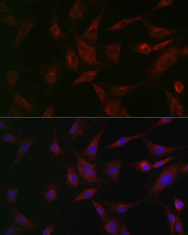 NSF Antibody in Immunocytochemistry (ICC/IF)