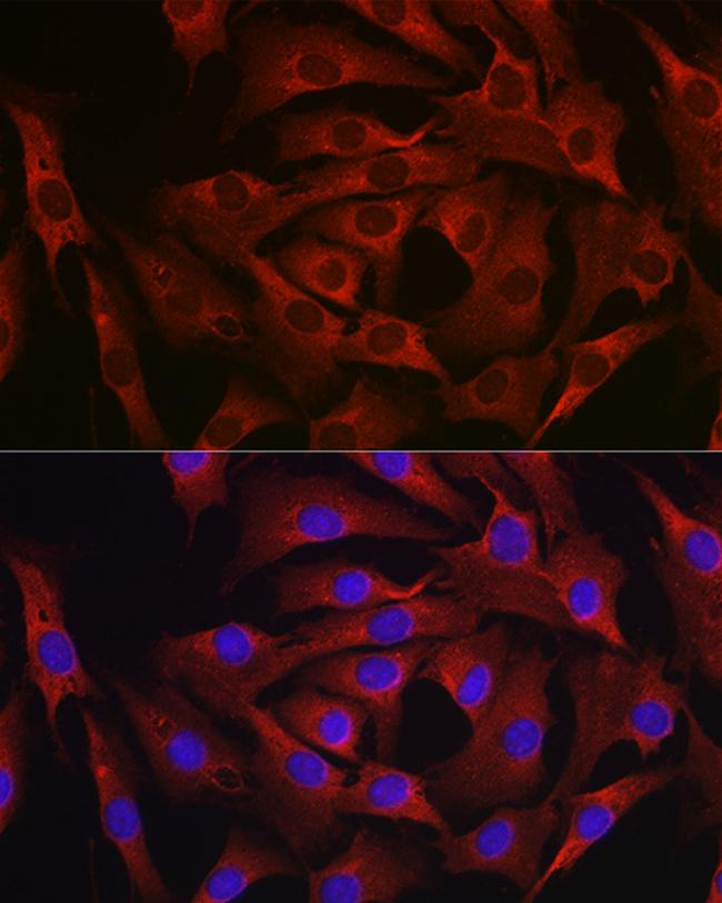 MARCKS Antibody in Immunocytochemistry (ICC/IF)