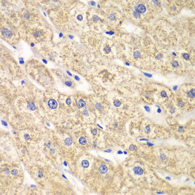 ACADS Antibody in Immunohistochemistry (Paraffin) (IHC (P))