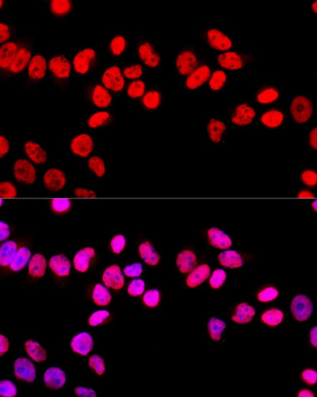 SFPQ Antibody in Immunocytochemistry (ICC/IF)