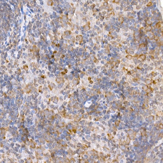 TRAF2 Antibody in Immunohistochemistry (Paraffin) (IHC (P))