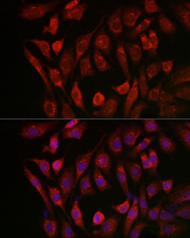 Cathepsin B Antibody in Immunocytochemistry (ICC/IF)