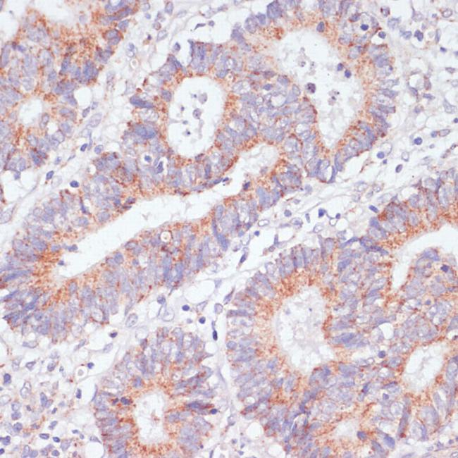 RAP1A Antibody in Immunohistochemistry (Paraffin) (IHC (P))