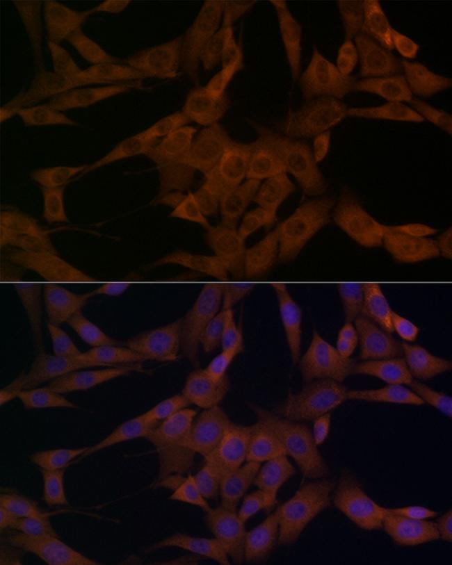 beta Arrestin 1 Antibody in Immunocytochemistry (ICC/IF)