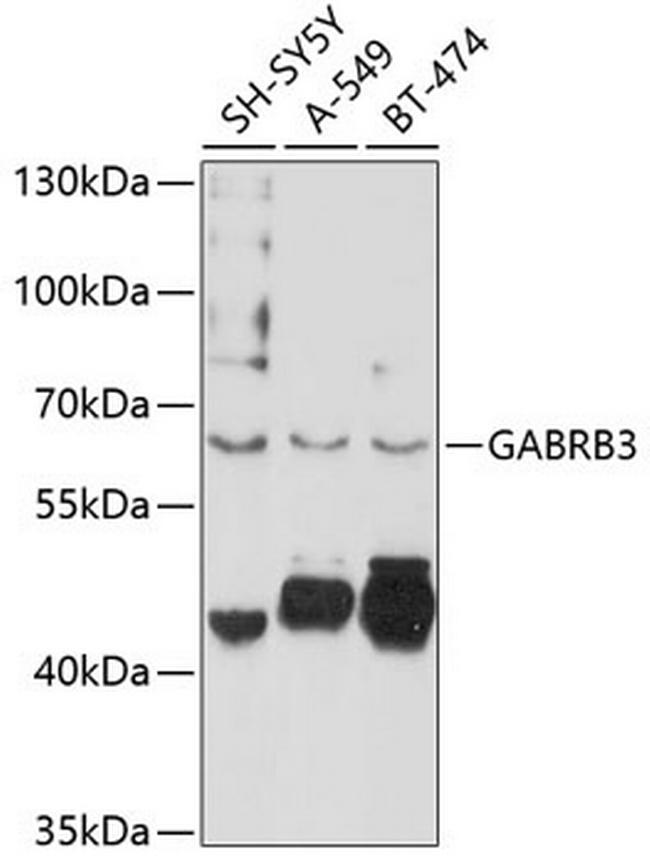 GABRB3 Antibody in Western Blot (WB)