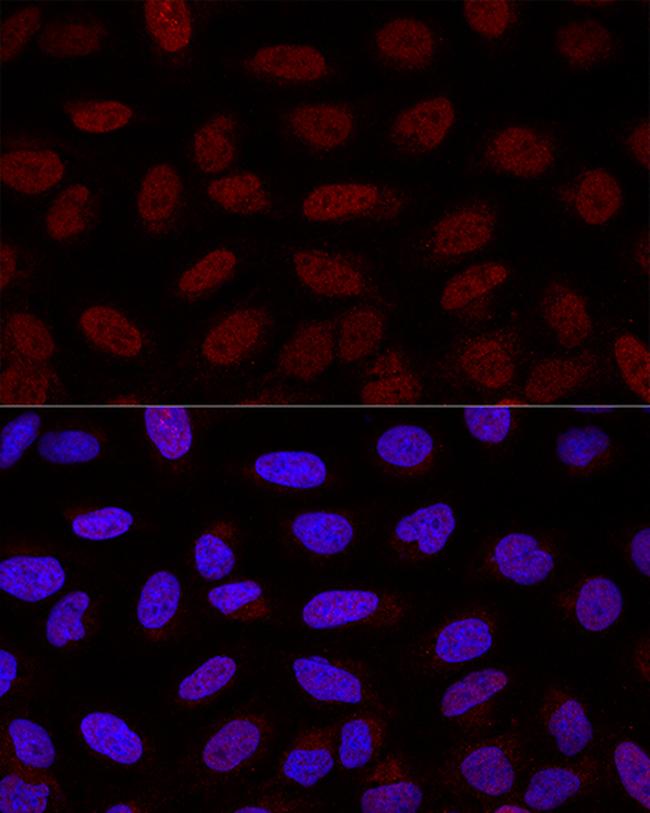 YAP1 Antibody in Immunocytochemistry (ICC/IF)