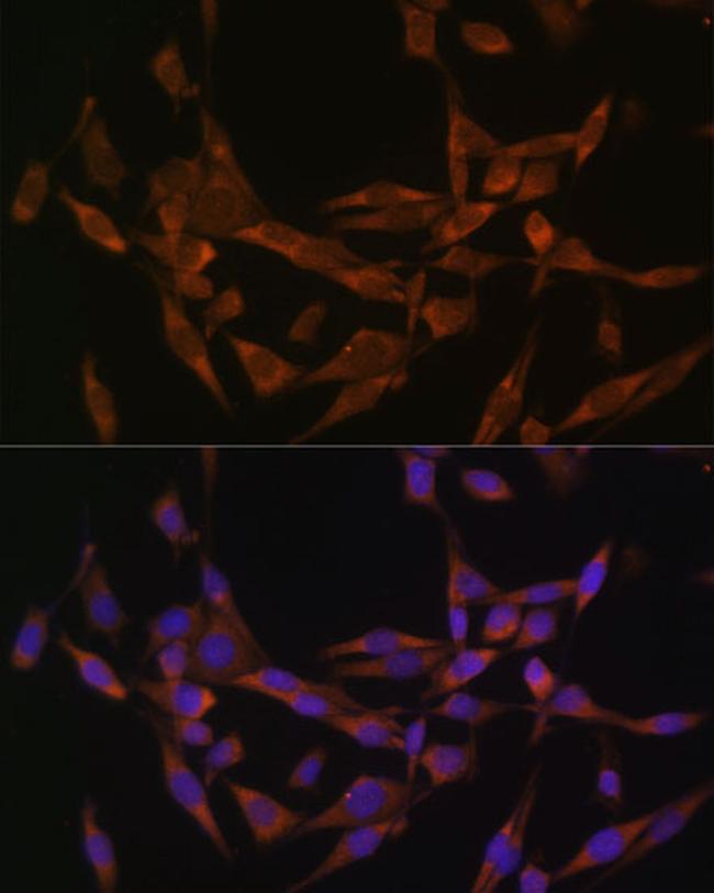 UBE2O Antibody in Immunocytochemistry (ICC/IF)