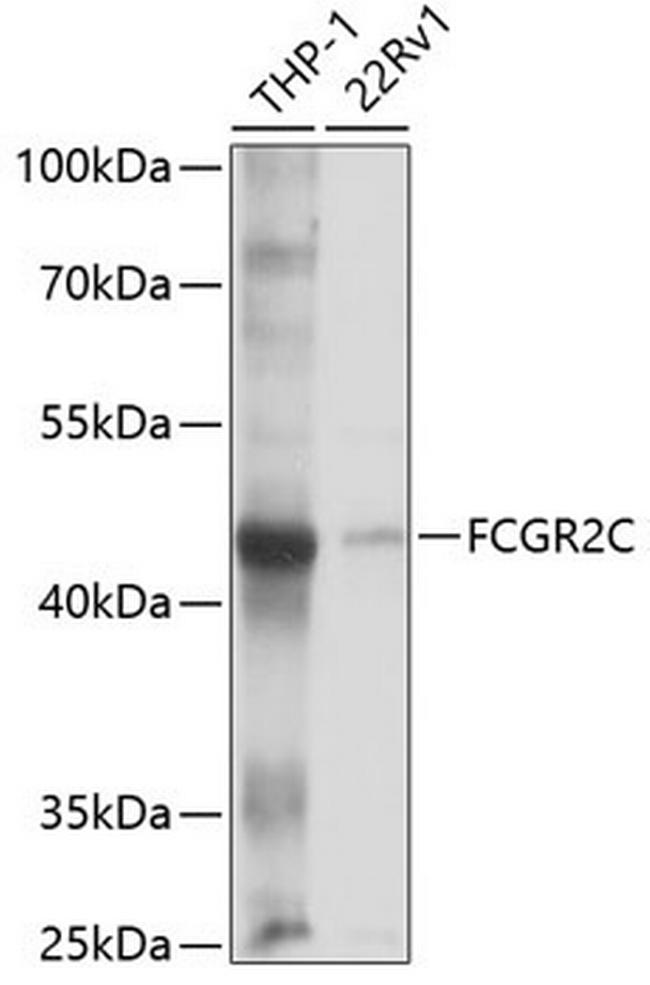 CD32 Antibody in Western Blot (WB)