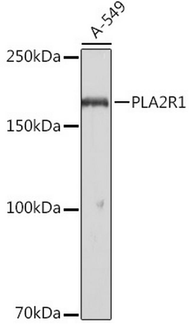 PLA2R1 Antibody in Western Blot (WB)