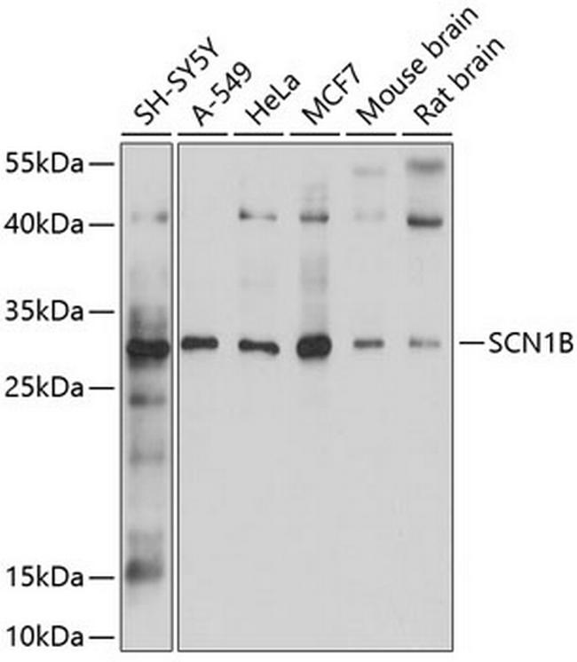 SCN1B Antibody in Western Blot (WB)