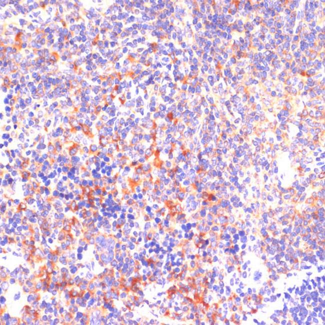 ROCK1 Antibody in Immunohistochemistry (Paraffin) (IHC (P))